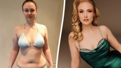 ‘I don’t feel less beautiful’